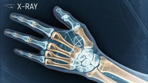 🧪 Digital X-Ray